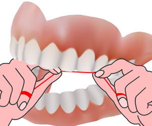 Flossing- Dental Floss