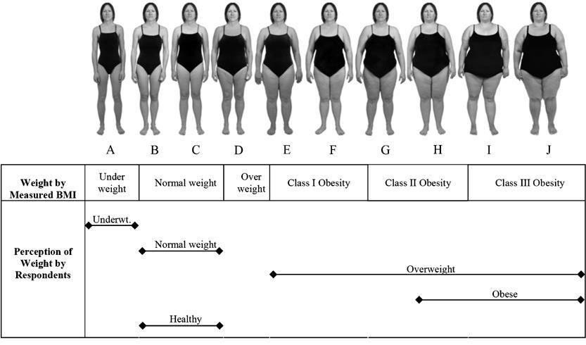 Journey of Obesity and Infertility